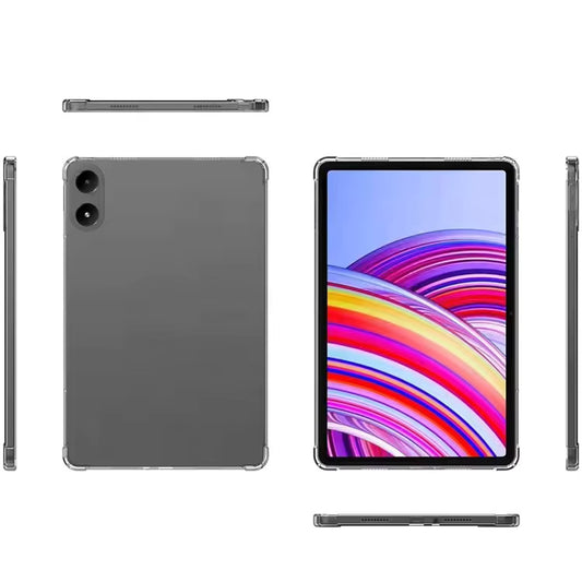 Valente Redmi Pad Pro clear case slim profile ports and buttons accessible