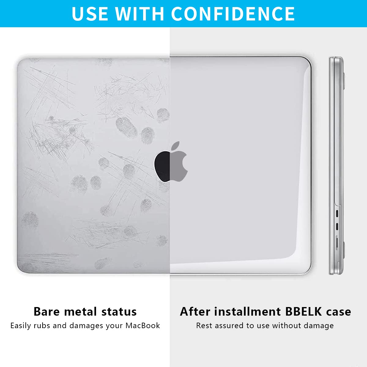 Valente Hard Shell Case with Keyboard Cover Compatible with MacBook Air 13.6 inch M2 / M3 / M4 | Transparent Protective Laptop Cover | Shockproof Anti-Scratch Case