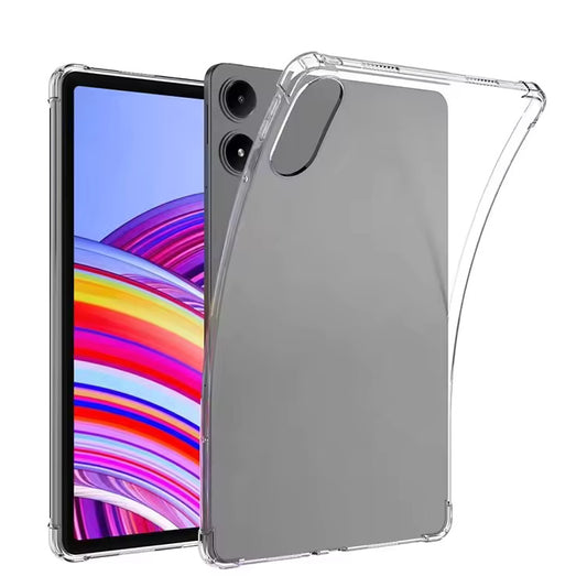 Valente Ultra-Clear Protective Case for Redmi Pad Pro - Slim, Scratch-Resistant, Full Device Access